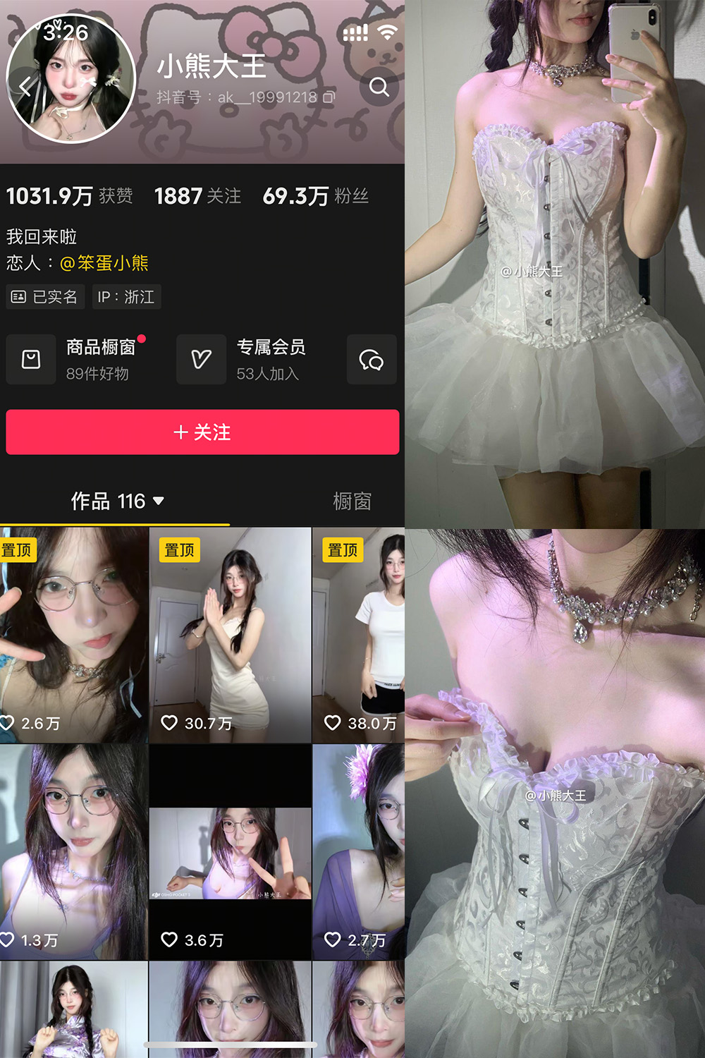 抖音 小熊大王 微密圈 001期 【32P】-桃花园